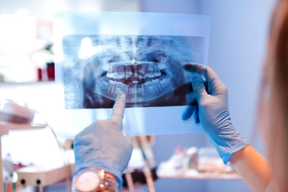 dentist pointing at dental x-ray | lakeville mn dentist