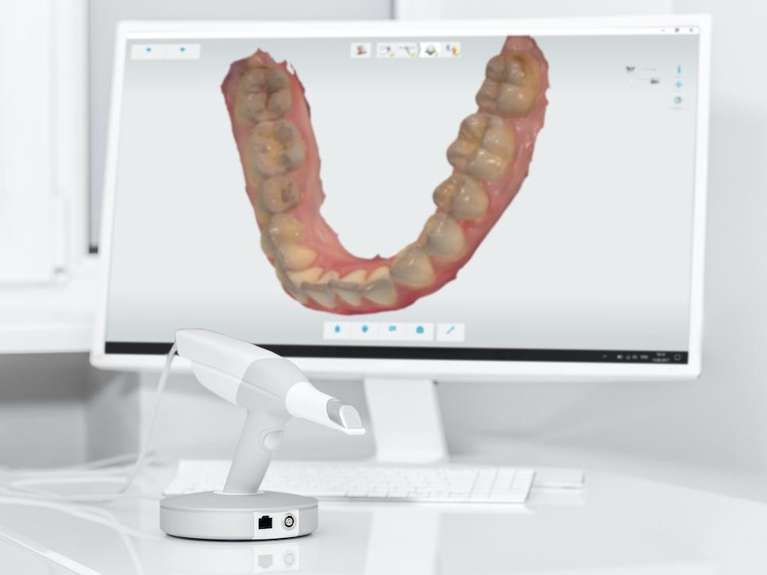 digital impression on computer screen | dentist 55044